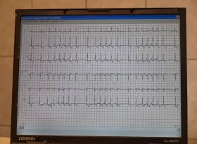 EKG vizsgálat